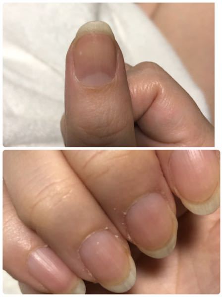 いすれも右手の親指爪、薬指爪に白点が同時期に出来ました。 なにかいみありますか？