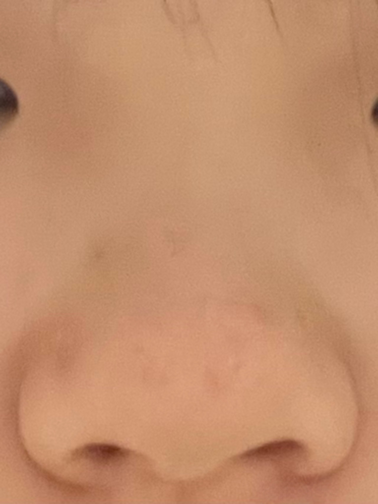 この鼻は何鼻ですか？またこの鼻をマシにする方法を教えてください