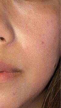 日焼け止めを塗ったあとパウダーをはたいていると 白い消しカスみたいな Yahoo 知恵袋