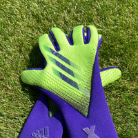 手首の怪我について昨日サッカーの練習でキーパーをしてたんですが 相手の弾 Yahoo 知恵袋