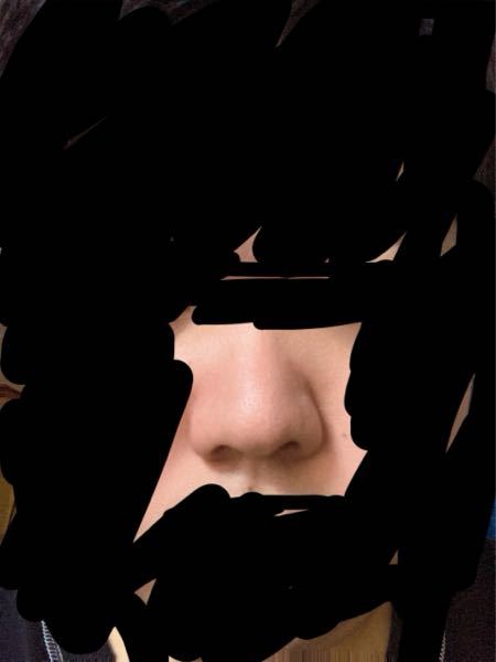 鼻がコンプレックスです。これって何鼻ですか？