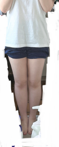 足が太いのですが この足で膝上スカートを履いたら見苦しいですか Yahoo 知恵袋