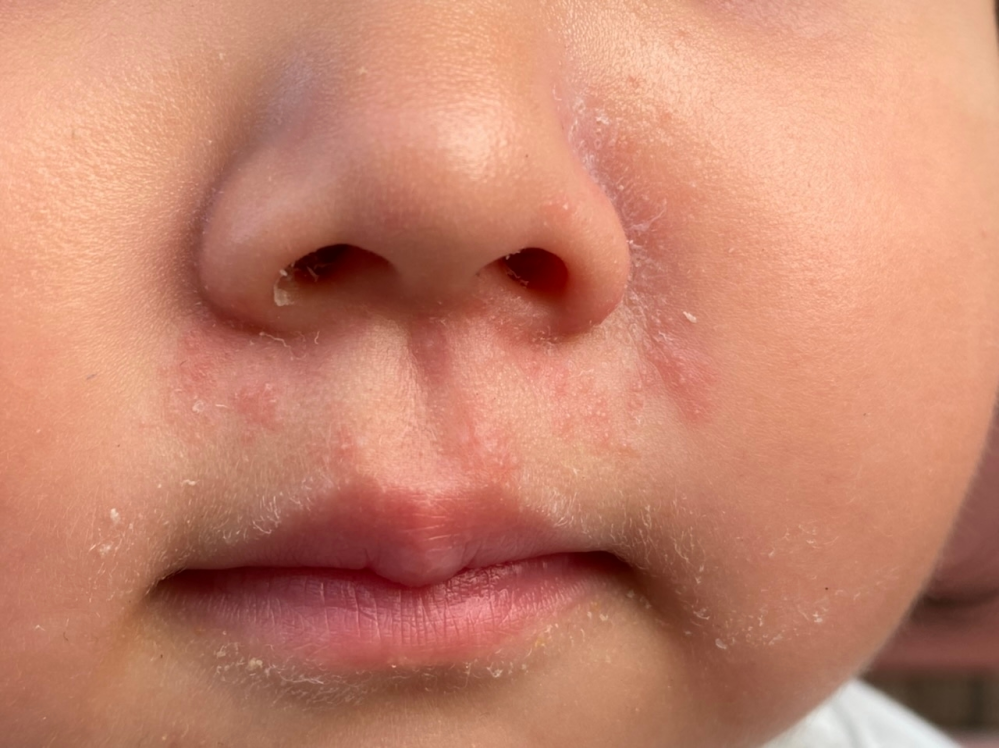 子どもの病気とトラブル 解決済みの質問 Yahoo 知恵袋