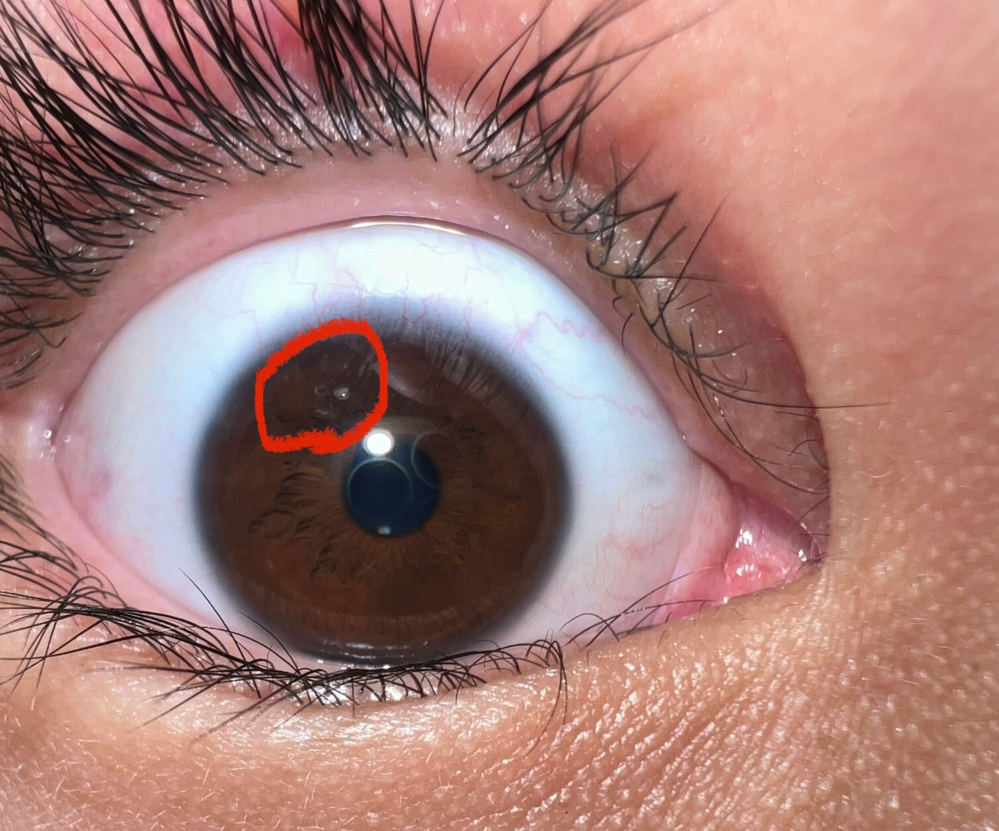 目の病気 投票受付中の質問 Yahoo 知恵袋