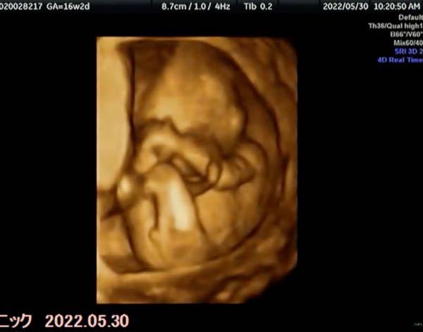 妊娠 出産 解決済みの質問 Yahoo 知恵袋