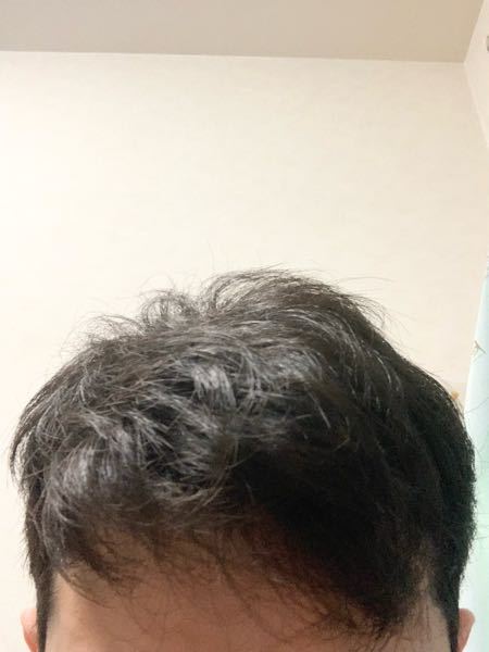 剛毛　素人 中古】芸能アイドルもじゃもじゃ剛毛ハプニング 御茶海マミ ...