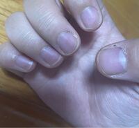 元ネイリストです 以前働いていたサロンにクレームしたいと思っている Yahoo 知恵袋