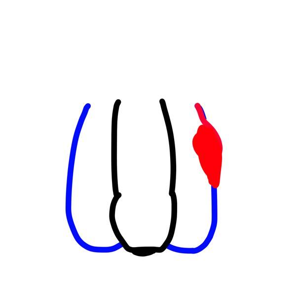 男性の病気 投票受付中の質問 Yahoo 知恵袋