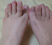 足の指が開きません 閲覧ありがとうございます 私は何故か足の指が開きませ Yahoo 知恵袋