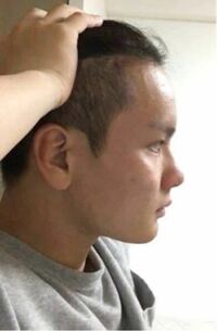 この横顔は 日本人の中でeラインがあるといえるんですか 回答お Yahoo 知恵袋