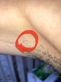 脇に小さなしこりのようなものが出来たのですが これは放置しても Yahoo 知恵袋