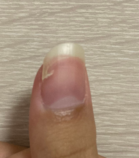 ハンターハンターの キルアの母親のキキョウはなぜあんな姿 Yahoo 知恵袋