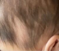 生後4ヶ月の赤ちゃんです 今までは綺麗に生えそろっていた Yahoo 知恵袋