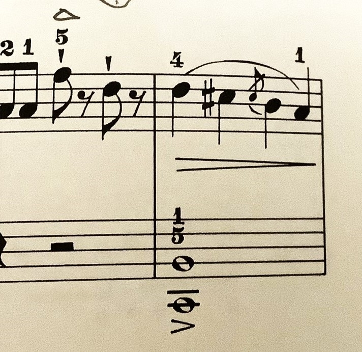 ピアノの練習ABCのO（練習曲１４）の練習中です。 添付の楽譜の短前打音がある小節の弾き方について確認させていただきたく。 １．短前打音に対しても、＃の効果が適用されて、ド＃となる、でよろしいで...