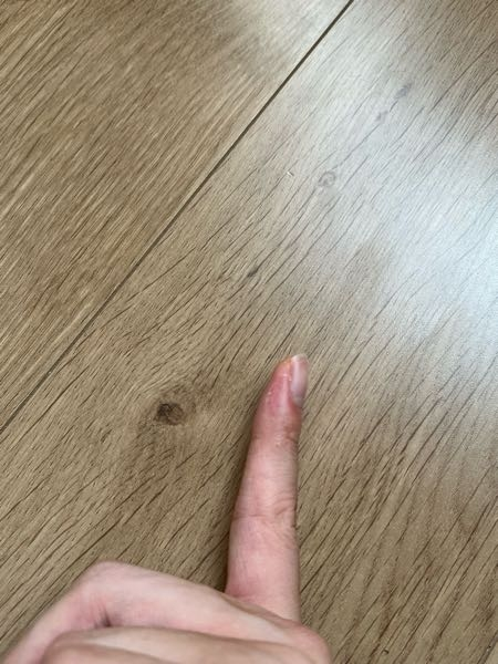 これは水虫でしょうか？ 数週間前にこの指をカミソリで切ってしまい1週間ほどキズパワーパッドをつけてました。外して1週間くらいたったころから指の皮が剥けてきました。 他の指や足は全く普通です。 爪...