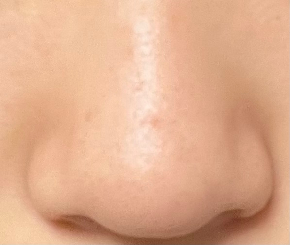 この鼻ってデカイですよね？？なのでこの鼻を小さくする方法を教えてください！