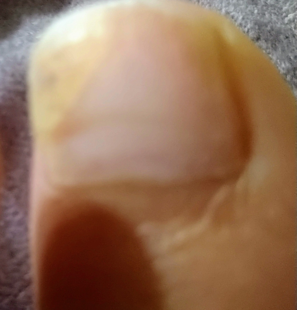 マニキュアで爪が変色していました。どうすれば元に戻るでしょうか？