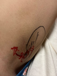 内転筋 股関節周辺が痛いです 中学の時に長距離していたのが原因だと思いま Yahoo 知恵袋