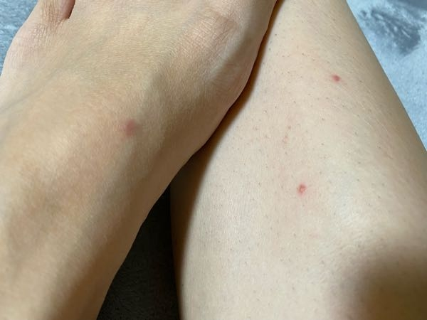 急に脚に赤い点々が現れました。 これがなんなのかわかる方いらっしゃいますか？ 3日ほど前に海に行ったのですがそれも関係があるのでしょうか？ 先程気づいてから少し痒いです。 蚊ではないです。
