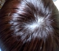 高1女です これはつむじはげですか それとも普通ですか 髪型は Yahoo 知恵袋