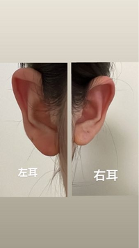 どの位置にピアス開けたら可愛いか教えてください 耳の形が変なのでどの位置 Yahoo 知恵袋
