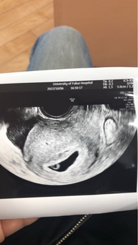 妊娠6週2日です 今日卵黄嚢の胎嚢は確認されたのですが胎芽や心 教えて しごとの先生 Yahoo しごとカタログ