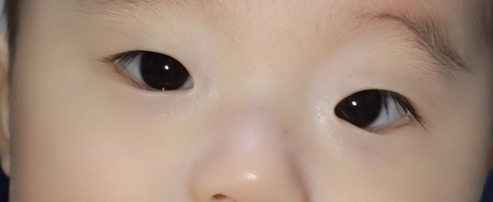 子どもの病気とトラブル 回答受付中の質問 Yahoo 知恵袋