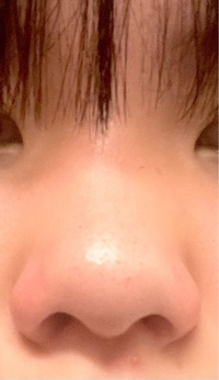 どうしましょう鼻がでかいです目の横幅が約3cm 鼻の幅が約4cmあります Yahoo 知恵袋
