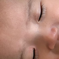 生後4ヶ月の子供の目の周りに小さなポツポツが気になっています Yahoo 知恵袋