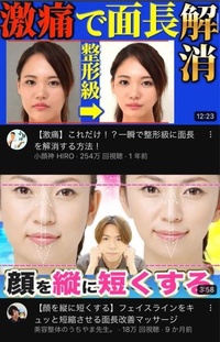 こういう動画のサムネですが ビフォーアフターの写真は本物なのでしょうか Yahoo 知恵袋