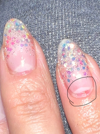 ネイルサロンから帰ってきたら黒で囲んである部分の赤みがあるとこ Yahoo 知恵袋