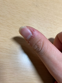 趣味は ササクレむきです 特技は 血を出さずにササクレをむく 教えて しごとの先生 Yahoo しごとカタログ