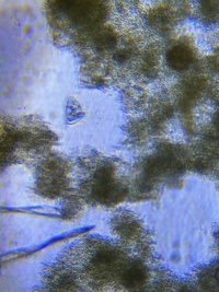 この微生物の名前は何ですか 宜しくお願い致します チューリップ Yahoo 知恵袋