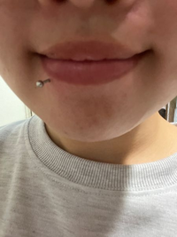 至急ピアスについて

リップ開けて笑ったらこうなるんですけど大丈夫でしょうか笑笑 
