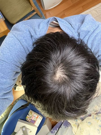 高校生です後頭部が禿げてると感じますがはげてますか？ハゲてるな... - Yahoo!知恵袋