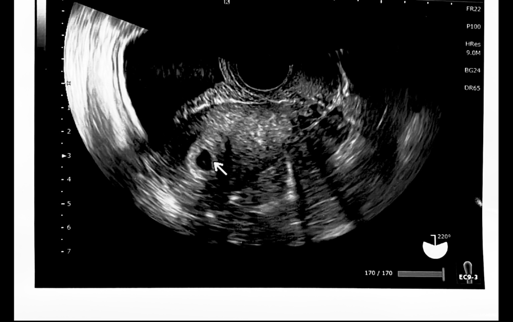妊娠初期のおりものってどんなかんじですか？ Yahoo!知恵袋