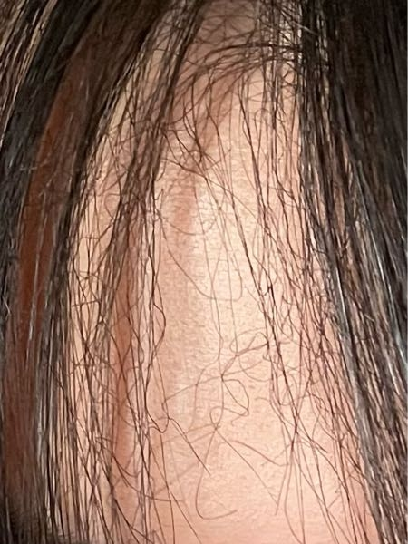 ヘアアイロンしたら髪の毛が画像のようになります。改善方法教えて欲しいです
