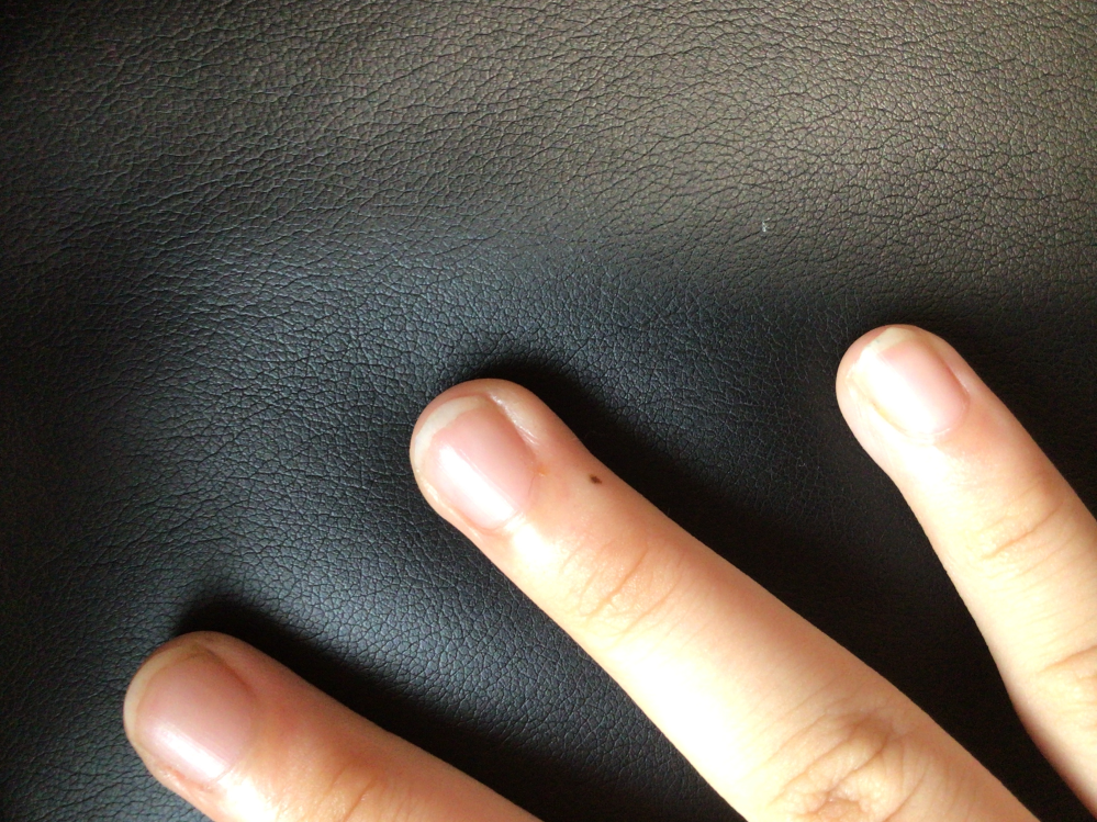 私は右手の薬指にほくろがあるのですが、何か意味があるのでしょうか。 