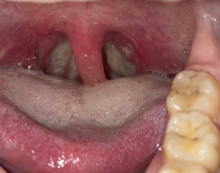 喉に入れてしまったのですが、どうやって見分ければよいのでしょうか？