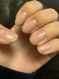 この爪でネイルモデルできると思いますか(T^T)経験者の方いくらぐらい貰えたか教えていただきたいです 