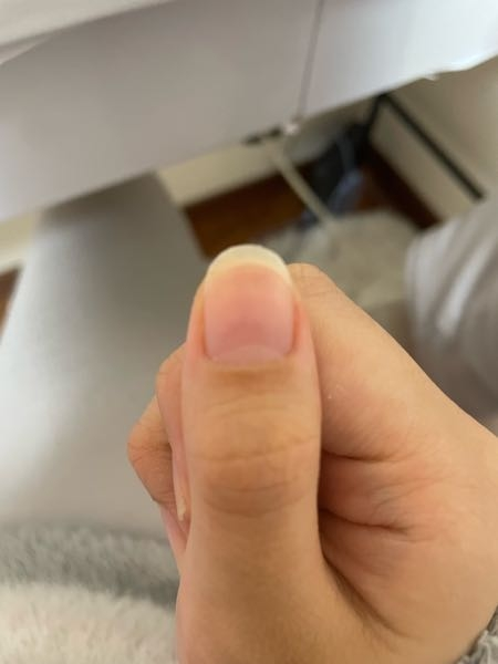 至急です！爪についてですこの1番下の白い部分ってどうやって増やすんでしょう何故か右の親指だけ白の面積が広く爪が長く見えるので他の指も同じ感じになりたいです 綺麗な指の方を見ると白い部分の面積がひろい気がします いちどネイルサロンのお姉さんにそれは甘皮じゃないのでとる必要ないと言われ終わってしまったのですが どうしても諦めきれません！ 右の親指だけ広いのは 爪をカリカリ自傷する癖が小さい頃からあるからかなと自分で思ってます 誰か教えてください！ 甘皮をとる時ついでに押していますが少し痛く無理やりは皮膚に良くないかなと思ってできていません