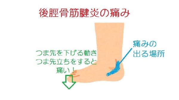 バドミントンのシューズについて質問です。自分はシューズの重さが軽くて、しっかり足を守ってくれるシューズが欲しいです。内くるぶしが腫れています。 そこで候補がウエーブクローNEO 2とPOWER CUSHION 65 Zこの二つの違いと自分に合っているのはどっちか教えていただけますか?