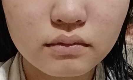 不細工なの知った上で言います整形以外で鼻を小さくする方法、口を大きくする方法教えてください(口が小さくて鼻が余計に大きく見えるからです)あの人を見返したいです、マジで病んでます 辛口でお願いします