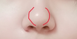 鼻を整形したいです。 1つ目の写真の鼻筋？鼻の真ん中(先端)が丸いのを真っ直ぐにしたいです。このような整形は出来ますか？ また何と調べれば出てきますか? 実際にどんな感じになるかとかも見てみたいのでこの部分の名称を教えてください。