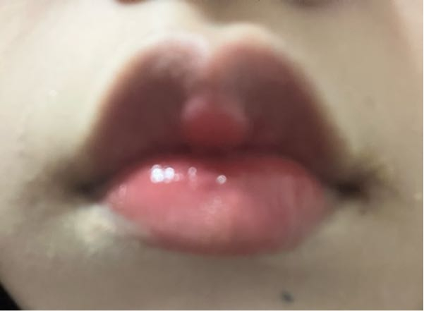 口元の写真が映っています。 この唇はM字リップですか？ また唇の形は変ですか？