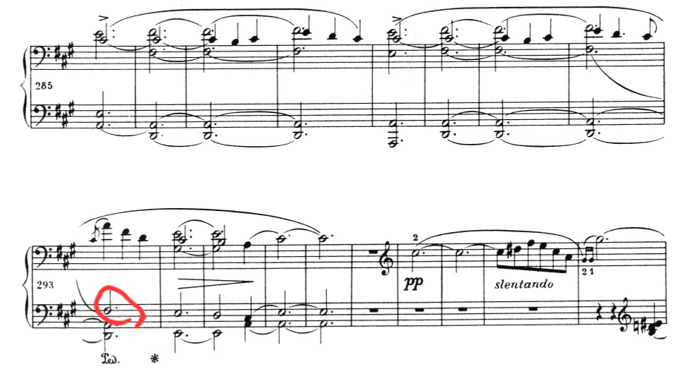 スケルツォ2番の弾きかたの質問です。 293小節目の左手の#ファはどう弾いてますか？ （中間のゆったりのあたり画像の部分） この3パターンを検討しました ①左手で弾き直して音を出す ②前小節右手で弾いたものをペダルで伸ばしたまま、何もひかない（右手は上の旋律のみを弾く） ③左手で押さえ直すが音は鳴らさない（おそらく、293頭でペダルを踏み変えるため音を響かせ続けることにする便宜上） 複数の楽譜や動画など見比べて検討したところ、②か③かなと思ったのですがあっていますか？ 仮に②か③があっている場合、いくつかの動画で①も結構みられたのですが、それは間違っているのか、もしくは、そう書かれている版もあるのでしょうか？ 皆さんはどう弾かれましたか？