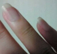 私は幼い頃から右手薬指の爪に茶色い線があるのですが これって何 Yahoo 知恵袋