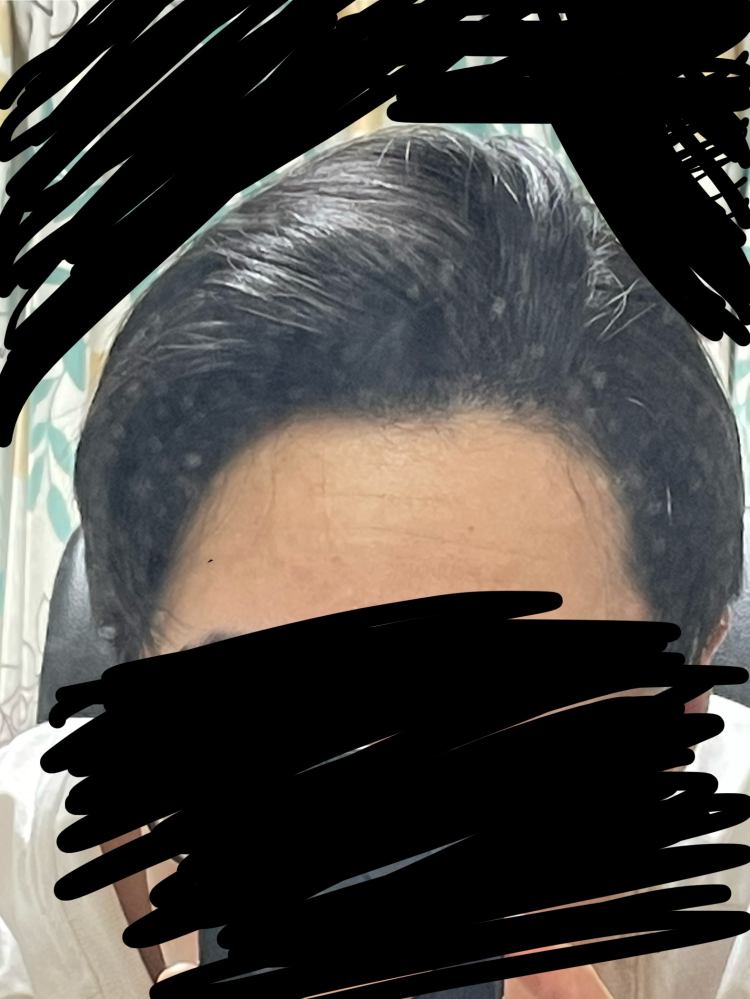 この髪型はダサいですか？ 正直にお願いします、 初めて縮毛矯正した結果、似合わずショックを受けました。。。 またどのようにすればマシになりますでしょうか？