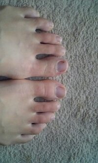 朝起きてから足の指だけがうっすら赤く痒いです 秋なのにしもやけ Yahoo 知恵袋