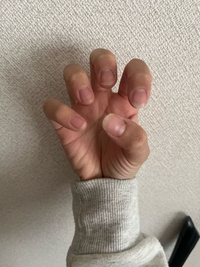 汚い手の写真すみません。高2女です。
私は爪の形がコンプレックスなのですが、最近ネイルをしたいなと考えています。 母や姉がネイルをしていて手元で写真を撮る時私だけなんか手元が寂しいというのと、可愛くして爪のむしり癖を改善したく、ネイルサロンでネイルをしようと考えています
ですが画像のように私の爪の形はすごく悪い＋むしってしまって形がバラバラです

このようなバランスの悪い爪の形でもネイルはし...